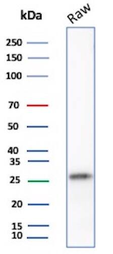 p27/Kip1 Antibody (SX53G8) - IHC-Prediluted Western Blot: p27/Kip1 Antibody (SX53G8) - IHC-Prediluted [NBP2-44493] -