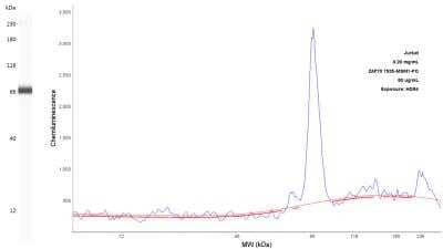 ZAP70 Antibody (2F3.2)