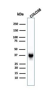 PMEL17/SILV Antibody (SPM142) - IHC-Prediluted Western Blot: PMEL17/SILV Antibody (SPM142) - IHC-Prediluted [NBP2-44521] -