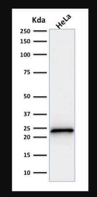 p21/CIP1/CDKN1A Antibody (SPM306)