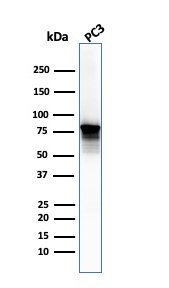 Moesin Antibody (SPM562) - IHC-Prediluted Western Blot: Moesin Antibody (SPM562) - IHC-Prediluted [NBP2-44578] -