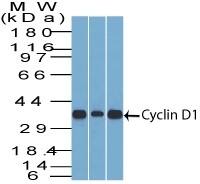 Cyclin D1 Antibody (DCS-6) - IHC-Prediluted Western Blot: Cyclin D1 Antibody (DCS-6) - IHC-Prediluted [NBP2-44584] -