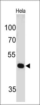 Pax7 Antibody (PAX7/497) - IHC-Prediluted Western Blot: Pax7 Antibody (PAX7/497) - IHC-Prediluted [NBP2-44587] -