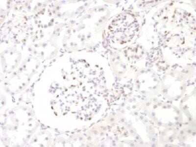 WT1 Antibody (WT1/857)