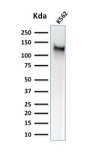 CD43/Sialophorin Antibody (SPM503) - IHC-Prediluted Western Blot: CD43/Sialophorin Antibody (SPM503) - IHC-Prediluted [NBP2-44647] -