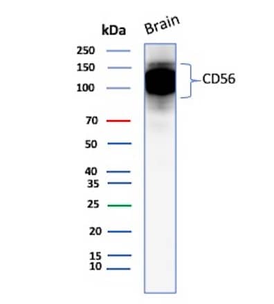 NCAM-1/CD56 Antibody (123C3.D5) - IHC-Prediluted Western Blot: NCAM-1/CD56 Antibody (123C3.D5) - IHC-Prediluted [NBP2-44711] -