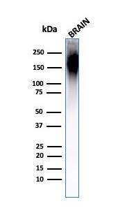 NF-H Antibody (NF421) - IHC-Prediluted Western Blot: NF-H Antibody (NF421) - IHC-Prediluted [NBP2-44724] -
