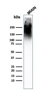NF-H Antibody (SPM563) - IHC-Prediluted Western Blot: NF-H Antibody (SPM563) - IHC-Prediluted [NBP2-44725] -