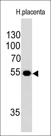 Ornithine Decarboxylase Antibody (ODC1/485) - IHC-Prediluted Western Blot: Ornithine Decarboxylase Antibody (ODC1/485) - IHC-Prediluted [NBP2-44732] -