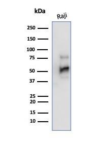 CD79A Antibody (JCB117) - IHC-Prediluted Western Blot: CD79A Antibody (JCB117) - IHC-Prediluted [NBP2-44736] -