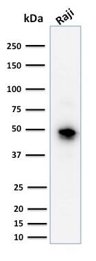 CD79A Antibody (JCB117) - IHC-Prediluted Western Blot: CD79A Antibody (JCB117) - IHC-Prediluted [NBP2-44736] -
