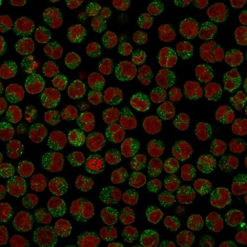 CD79A Antibody (SPM549) - IHC-Prediluted Immunocytochemistry/ Immunofluorescence: CD79A Antibody (SPM549) - IHC-Prediluted [NBP2-44737] -