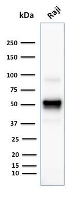 CD79A Antibody (SPM549) - IHC-Prediluted Western Blot: CD79A Antibody (SPM549) - IHC-Prediluted [NBP2-44737] -