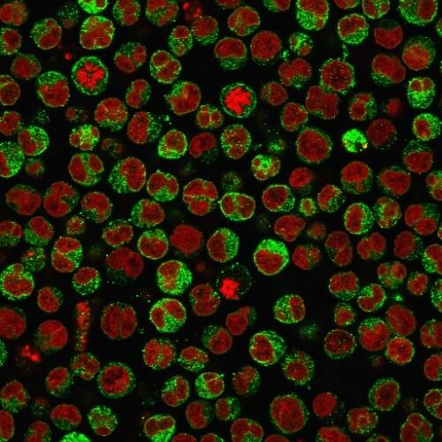 CD79A Antibody (SPM550) - IHC-Prediluted Immunocytochemistry/ Immunofluorescence: CD79A Antibody (SPM550) - IHC-Prediluted [NBP2-44739] -