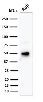 CD79A Antibody (JCB117 + HM47/A9) - IHC-Prediluted Western Blot: CD79A Antibody (JCB117 + HM47/A9) - IHC-Prediluted [NBP2-44740] -