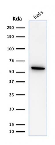 HSP60 Antibody (SPM253) - IHC-Prediluted Western Blot: HSP60 Antibody (SPM253) - IHC-Prediluted [NBP2-44755] -