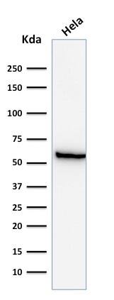 HSP60 Antibody (GROEL/730) - IHC-Prediluted Western Blot: HSP60 Antibody (GROEL/730) - IHC-Prediluted [NBP2-44757] -