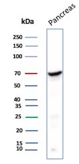Chromogranin A Antibody (LK2H10) - IHC-Prediluted Western Blot: Chromogranin A Antibody (LK2H10) - IHC-Prediluted [NBP2-44767] -