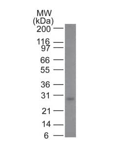 Bcl-2 Antibody (100/D5) - IHC-Prediluted Western Blot: Bcl-2 Antibody (100/D5) - IHC-Prediluted [NBP2-44777] -