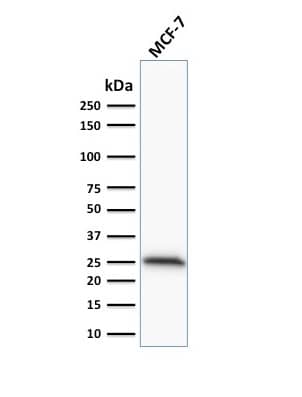 Bcl-2 Antibody (100/D5) - IHC-Prediluted Western Blot: Bcl-2 Antibody (100/D5) - IHC-Prediluted [NBP2-44777] -