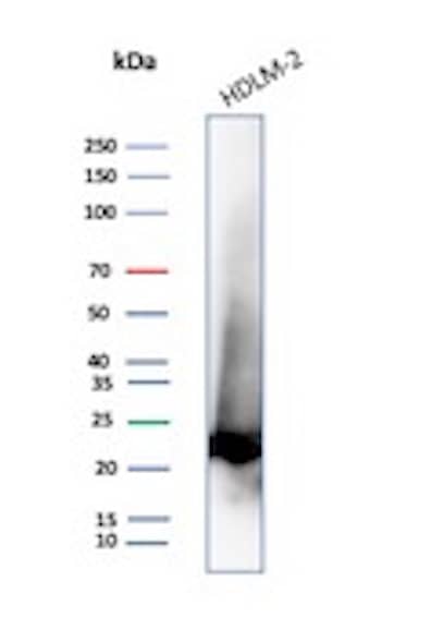 Bcl-2 Antibody (100/D5) - IHC-Prediluted Western Blot: Bcl-2 Antibody (100/D5) - IHC-Prediluted [NBP2-44777] -