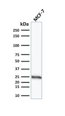 Bcl-2 Antibody (SPM117) - IHC-Prediluted Western Blot: Bcl-2 Antibody (SPM117) - IHC-Prediluted [NBP2-44778] -