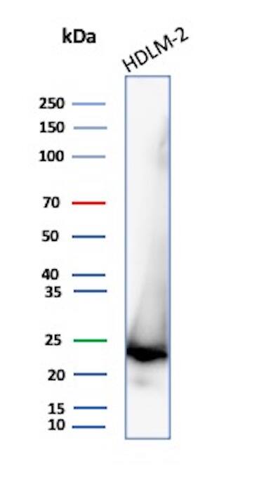 Bcl-2 Antibody (8C8) - IHC-Prediluted Western Blot: Bcl-2 Antibody (8C8) - IHC-Prediluted [NBP2-44779] -