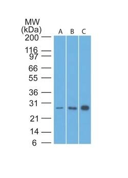 Bcl-2 Antibody (8C8) - IHC-Prediluted Western Blot: Bcl-2 Antibody (8C8) - IHC-Prediluted [NBP2-44779] -