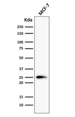 Bcl-2 Antibody (124) - IHC-Prediluted Western Blot: Bcl-2 Antibody (124) - IHC-Prediluted [NBP2-44780] -