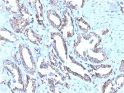 Cytokeratin 7 Antibody (OV-TL12/30)