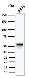 Vimentin Antibody (VM452) - IHC-Prediluted Western Blot: Vimentin Antibody (VM452) - IHC-Prediluted [NBP2-44830] -