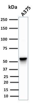 Vimentin Antibody (SPM576) - IHC-Prediluted Western Blot: Vimentin Antibody (SPM576) - IHC-Prediluted [NBP2-44831] -