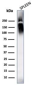 CD45 Antibody (SPM569 + SPM570) - IHC-Prediluted Western Blot: CD45 Antibody (SPM569 + SPM570) - IHC-Prediluted [NBP2-44858] -
