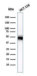 Cytokeratin 8 Antibody (H1) - IHC-Prediluted Western Blot: Cytokeratin 8 Antibody (H1) - IHC-Prediluted [NBP2-44932] -