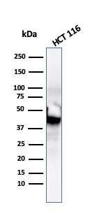 Cytokeratin 8 Antibody (SPM192) - IHC-Prediluted Western Blot: Cytokeratin 8 Antibody (SPM192) - IHC-Prediluted [NBP2-44936] -