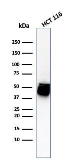 Cytokeratin 8 Antibody (H1+TS1) - IHC-Prediluted Western Blot: Cytokeratin 8 Antibody (H1+TS1) - IHC-Prediluted [NBP2-44937] -