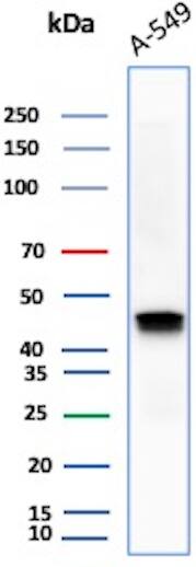 Cytokeratin 18 Antibody (DC10) - IHC-Prediluted Western Blot: Cytokeratin 18 Antibody (DC10) - IHC-Prediluted [NBP2-44943] -
