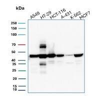 Cytokeratin 18 Antibody (DC10) - IHC-Prediluted Western Blot: Cytokeratin 18 Antibody (DC10) - IHC-Prediluted [NBP2-44943] -