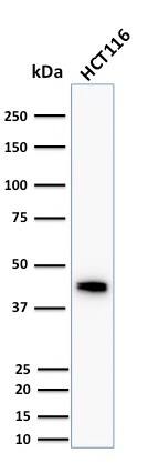 Cytokeratin 18 Antibody (DC10) - IHC-Prediluted Western Blot: Cytokeratin 18 Antibody (DC10) - IHC-Prediluted [NBP2-44943] -