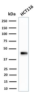 Cytokeratin 18 Antibody (SPM265) - IHC-Prediluted Western Blot: Cytokeratin 18 Antibody (SPM265) - IHC-Prediluted [NBP2-44944] -