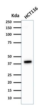 Cytokeratin 18 Antibody (DA7) - IHC-Prediluted Western Blot: Cytokeratin 18 Antibody (DA7) - IHC-Prediluted [NBP2-44945] -