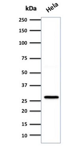 HSP27 Antibody (SPM252) - IHC-Prediluted Western Blot: HSP27 Antibody (SPM252) - IHC-Prediluted [NBP2-44974] -
