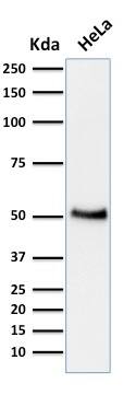 p53 Antibody (BP53-12) - IHC-Prediluted Western Blot: p53 Antibody (BP53-12) - IHC-Prediluted [NBP2-44976] -