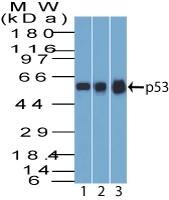 p53 Antibody (BP53-12) - IHC-Prediluted Western Blot: p53 Antibody (BP53-12) - IHC-Prediluted [NBP2-44976] -