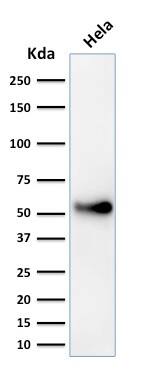 p53 Antibody (SPM589) - IHC-Prediluted Western Blot: p53 Antibody (SPM589) - IHC-Prediluted [NBP2-44977] -