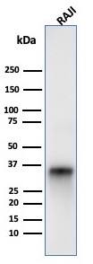 CD74 Antibody (LN-2) - IHC-Prediluted Western Blot: CD74 Antibody (LN-2) - IHC-Prediluted [NBP2-44988] -