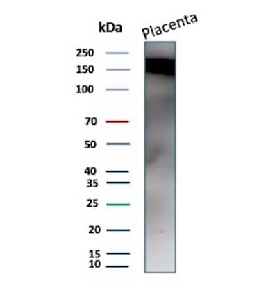 Fibronectin Antibody (568) Western Blot: Fibronectin Antibody (568) [NBP2-45018] -