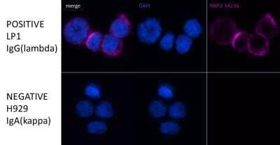 Lambda Light Chain Antibody (LcN-2 + ICO-106) - IHC-Prediluted Immunocytochemistry/ Immunofluorescence: Lambda Light Chain Antibody (LcN-2 + ICO-106) - IHC-Prediluted [NBP2-45077] -