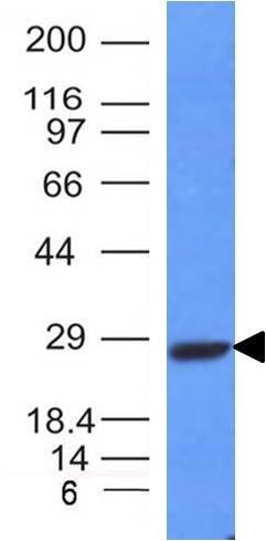 Kappa Light Chain Antibody (L1C1) - IHC-Prediluted Western Blot: Kappa Light Chain Antibody (L1C1) - IHC-Prediluted [NBP2-45079] -