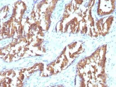 Isocitrate Dehydrogenase 1/IDH1 Antibody (IDH1/1152)